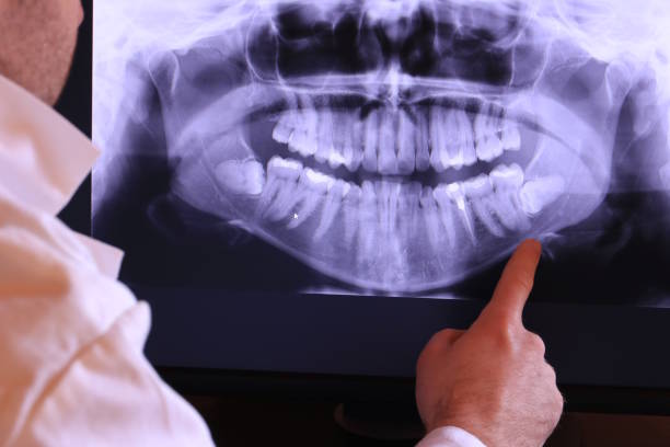 Best Emergency Dental Extractions in Omak, WA