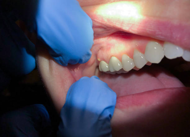 Best Mobile Emergency Dentist in Omak, WA